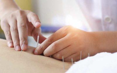Case Studies #2 – Acupuncture Treatment for Pain Related to  Anemia and Diet Modification: A Case Report