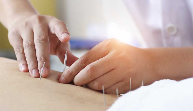 Case Studies #2 – Acupuncture Treatment for Pain Related to  Anemia and Diet Modification: A Case Report